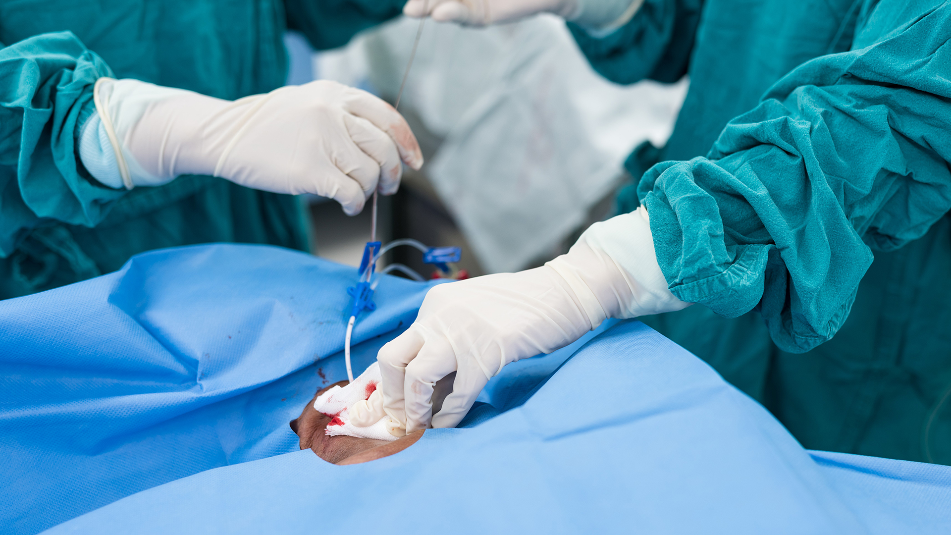 Máster en Intervencionismo Endovascular Estructural 2025-2027